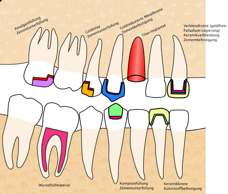 Zahnheilkunde: Störfelder im Körper